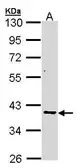Anti-AKR7A2 antibody used in Western Blot (WB). GTX104299