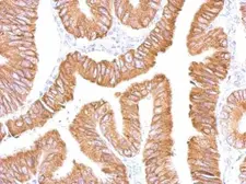 Anti-CES2 antibody used in IHC (Paraffin sections) (IHC-P). GTX104337