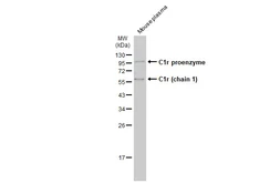 Anti-C1r antibody used in Western Blot (WB). GTX104350