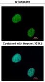 Anti-GLI3 antibody used in Immunocytochemistry/ Immunofluorescence (ICC/IF). GTX104362