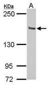 Anti-GLI3 antibody used in Western Blot (WB). GTX104362