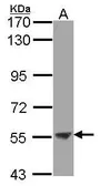 Anti-ENTPD3 antibody [N3C3] used in Western Blot (WB). GTX104376