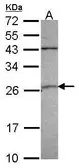 Anti-GSTA4 antibody [N1C3] used in Western Blot (WB). GTX104390