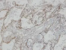 Anti-CLIC3 antibody [N1C3] used in IHC (Paraffin sections) (IHC-P). GTX104397