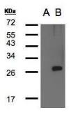 Anti-LYPLA1 antibody [N1C3] used in Western Blot (WB). GTX104398