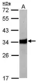 Anti-HAAO antibody [N1C3] used in Western Blot (WB). GTX104402