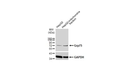 Anti-Grp75 antibody used in Western Blot (WB). GTX104407