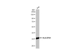 Anti-HLA-DPA1 antibody used in Western Blot (WB). GTX104414