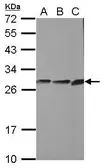 Anti-CYB5R2 antibody [N1C2] used in Western Blot (WB). GTX104417