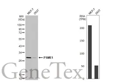 Anti-PSME1 antibody [N1C3] used in Western Blot (WB). GTX104422