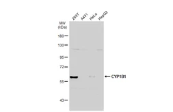Anti-CYP1B1 antibody used in Western Blot (WB). GTX104424
