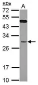 Anti-QDPR antibody used in Western Blot (WB). GTX104428