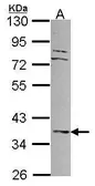 Anti-DUSP6 antibody [N3C3] used in Western Blot (WB). GTX104449
