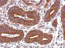 Anti-HLA-DQB2 antibody used in IHC (Paraffin sections) (IHC-P). GTX104461