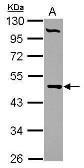 Anti-PCYT2 antibody used in Western Blot (WB). GTX104462