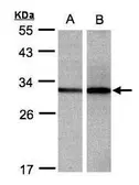 Anti-DCI antibody [N1C3] used in Western Blot (WB). GTX104473