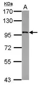 Anti-FAM48A antibody [N2C1], Internal used in Western Blot (WB). GTX104474