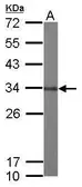 Anti-GLOD4 antibody [N1C3] used in Western Blot (WB). GTX104484