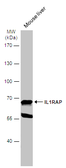 Anti-IL1RAP antibody [N1N3] used in Western Blot (WB). GTX104513