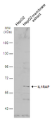 Anti-IL1RAP antibody [N1N3] used in Western Blot (WB). GTX104513
