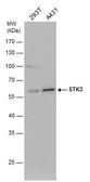 Anti-STK3 antibody used in Western Blot (WB). GTX104525