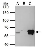Anti-ETS2 antibody used in Immunoprecipitation (IP). GTX104527