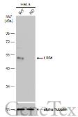 Anti-LDB1 antibody [N2C3] used in Western Blot (WB). GTX104531