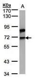 Anti-Splicing factor 1 antibody [N1N3] used in Western Blot (WB). GTX104540