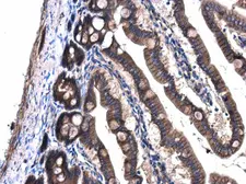 Anti-GNAQ antibody used in IHC (Paraffin sections) (IHC-P). GTX104544