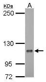 Anti-HURP antibody [N2C1], Internal used in Western Blot (WB). GTX104561