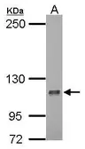 Anti-HURP antibody [N2C1], Internal used in Western Blot (WB). GTX104561