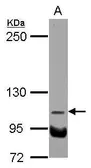 Anti-NDST3 antibody used in Western Blot (WB). GTX104563