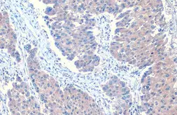 Anti-ANGPTL3 antibody used in IHC (Paraffin sections) (IHC-P). GTX104569