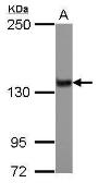 Anti-ZNF217 antibody [N3C2], Internal used in Western Blot (WB). GTX104572