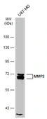 Anti-MMP2 antibody used in Western Blot (WB). GTX104577
