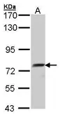 Anti-QSOX1 antibody [N2C2], Internal used in Western Blot (WB). GTX104581