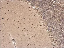 Anti-CSB antibody [N2C1], Internal used in IHC (Paraffin sections) (IHC-P). GTX104589