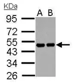Anti-RCC1 antibody used in Western Blot (WB). GTX104590
