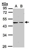 Anti-GALK2 antibody [N1C3] used in Western Blot (WB). GTX104594