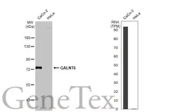 Anti-GALNT6 antibody [N1C2] used in Western Blot (WB). GTX104602