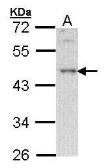 Anti-BLNK antibody [C3], C-term used in Western Blot (WB). GTX104614
