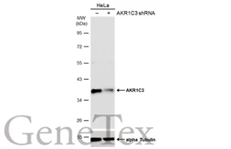 Anti-AKR1C3 antibody [C2C3], C-term used in Western Blot (WB). GTX104627