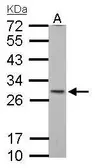 Anti-SDHB antibody [C2C3], C-term used in Western Blot (WB). GTX104628