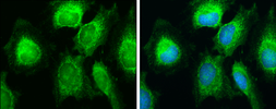 Anti-SDHB antibody [C2C3], C-term used in Immunocytochemistry/ Immunofluorescence (ICC/IF). GTX104628