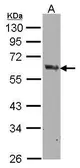 Anti-COX1 antibody [C3], C-term used in Western Blot (WB). GTX104634