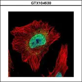 Anti-Tankyrase 2 antibody [N1], N-term used in Immunocytochemistry/ Immunofluorescence (ICC/IF). GTX104638