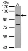 Anti-USP28 antibody [C3], C-term used in Western Blot (WB). GTX104646
