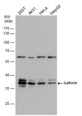 Anti-Laforin antibody [C2C3], C-term used in Western Blot (WB). GTX104648