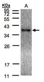 Anti-Laforin antibody [C2C3], C-term used in Western Blot (WB). GTX104648