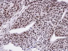 Anti-FCP1 antibody used in IHC (Paraffin sections) (IHC-P). GTX104649